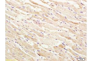 Immunohistochemistry (Paraffin-embedded Sections) (IHC (p)) image for anti-Mitogen-Activated Protein Kinase Kinase Kinase 5 (MAP3K5) (pThr845) antibody (ABIN683128)