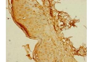 Immunohistochemistry of paraffin-embedded human skin tissue using ABIN7174896 at dilution of 1:100 (C8orf34 antibody  (AA 1-300))
