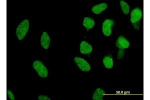 Immunofluorescence (IF) image for anti-MAX Interactor 1 (MXI1) (AA 1-182) antibody (ABIN518116)