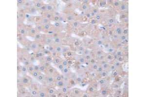 IHC-P analysis of Human Tissue, with DAB staining. (HSPG2 antibody  (AA 4149-4391))