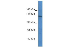 WB Suggested Anti-LTBP1 Antibody Titration: 0. (LTBP1 antibody  (C-Term))