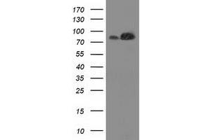 HEK293T cells were transfected with the pCMV6-ENTRY control (Left lane) or pCMV6-ENTRY FAM40A (Right lane) cDNA for 48 hrs and lysed. (STRIP1 antibody)