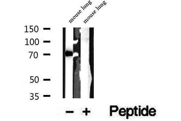 CCDC22 antibody  (C-Term)