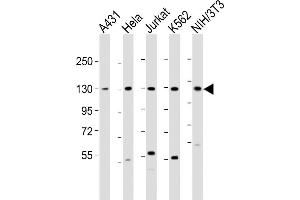 All lanes : Anti-DDX42 Antibody (N-Term) at 1:2000 dilution Lane 1: A431 whole cell lysate Lane 2: Hela whole cell lysate Lane 3: Jurkat whole cell lysate Lane 4: K562 whole cell lysate Lane 5: NIH/3T3 whole cell lysate Lysates/proteins at 20 μg per lane. (DDX42 antibody  (AA 104-138))