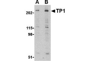 Western Blotting (WB) image for anti-Transition Protein 1 (During Histone To Protamine Replacement) (TNP1) (N-Term) antibody (ABIN1031638) (TNP1 antibody  (N-Term))