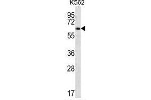 ZNF623 Antibody (C-term) western blot analysis in K562 cell line lysates (35 µg/lane). (ZNF623 antibody  (C-Term))