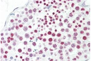 Human Testis: Formalin-Fixed, Paraffin-Embedded (FFPE) (EPC1 antibody  (AA 323-372))