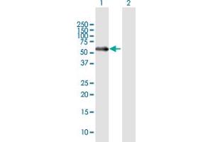 Western Blot analysis of MATN1 expression in transfected 293T cell line by MATN1 MaxPab polyclonal antibody. (MATN1 antibody  (AA 1-496))