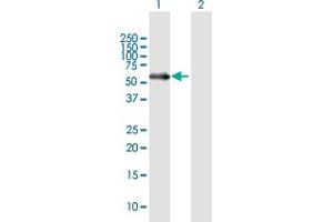 Western Blot analysis of MATN1 expression in transfected 293T cell line by MATN1 MaxPab polyclonal antibody.