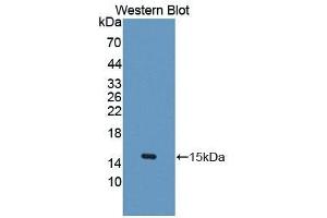 Detection of Recombinant UBAP2, Human using Polyclonal Antibody to Ubiquitin Associated Protein 2 (UBAP2) (UBAP2 antibody  (AA 1-104))
