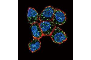 Confocal immunofluorescent analysis of ESR1/ER Antibody (Center) (ABIN657470 and ABIN2846498) with ZR-75-1 cell followed by Alexa Fluor 488-conjugated goat anti-rabbit lgG (green). (Estrogen Receptor alpha antibody  (AA 246-273))