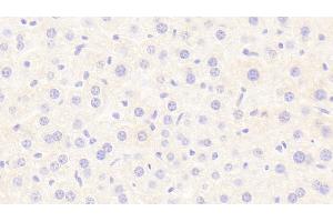 Detection of LIPC in Mouse Liver Tissue using Polyclonal Antibody to Lipase, Hepatic (LIPC) (LIPC antibody  (AA 159-415))