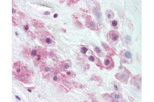 Anti-TJP2 / ZO-2 antibody IHC of human placenta, intermediate trophoblasts. (TJP2 antibody  (C-Term))