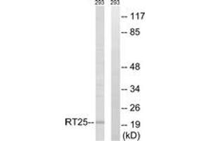 Western blot analysis of extracts from 293 cells, using MRPS25 Antibody. (MRPS25 antibody  (AA 124-173))