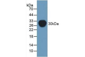 Western blot analysis of recombinant Mouse Pgp. (ABCB1 antibody)