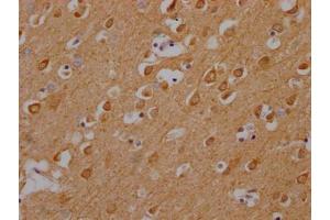 IHC image of ABIN7146440 diluted at 1:200 and staining in paraffin-embedded human brain tissue performed on a Leica BondTM system. (CAMK2A antibody  (AA 321-478))