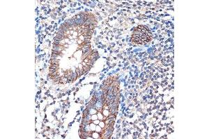 Immunohistochemistry of paraffin-embedded human appendix using LI Cadherin/Cadherin-17 Rabbit mAb (ABIN7268249) at dilution of 1:100 (40x lens). (LI Cadherin antibody)