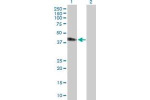 Western Blot analysis of IFNAR2 expression in transfected 293T cell line by IFNAR2 MaxPab polyclonal antibody. (IFNAR2 antibody  (AA 1-331))