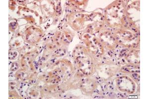 Formalin-fixed and paraffin embedded human kidney labeled with Anti-Phospho-SGK1 (Ser78) Polyclonal Antibody, Unconjugated (ABIN745688) at 1:200 followed by conjugation to the secondary antibody and DAB staining (SGK1 antibody  (pSer78))