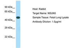 Image no. 1 for anti-NOP2/Sun Domain Family, Member 5 (NSUN5) (C-Term) antibody (ABIN6749897) (NSUN5 antibody  (C-Term))