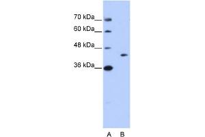 WB Suggested Anti-GIPC1 Antibody Titration:  0.