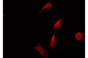 anti-Olfactory Receptor, Family 52, Subfamily A, Member 4 (OR52A4) antibody