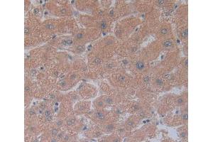 Figure. (CEACAM1 antibody  (AA 35-320))