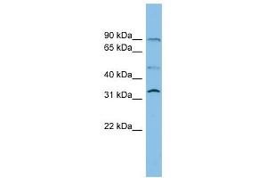 SLC27A3 antibody used at 1 ug/ml to detect target protein.