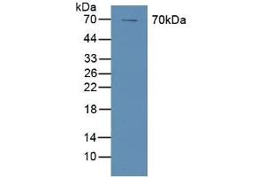 Detection of COX-1 in Human A431 Cells using Polyclonal Antibody to Cyclooxygenase 1 (COX-1) (PTGS1 antibody  (AA 367-599))
