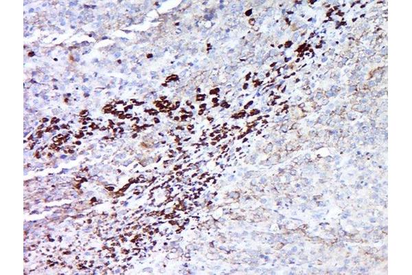 MAGEA5 antibody  (AA 41-124)
