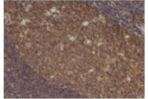Image no. 3 for anti-Chemokine (C-C Motif) Ligand 5 (CCL5) antibody (ABIN465158) (CCL5 antibody)