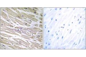 Immunohistochemistry analysis of paraffin-embedded human heart tissue, using LAMA4 Antibody. (LAMa4 antibody  (AA 481-530))