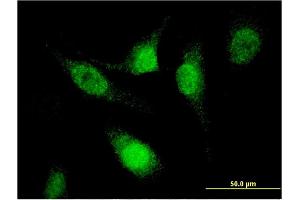Immunofluorescence of monoclonal antibody to SFRS12 on HeLa cell. (SFRS12 antibody  (AA 443-508))
