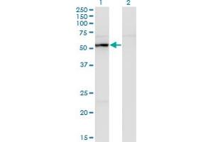 Western Blot analysis of UAP1 expression in transfected 293T cell line by UAP1 monoclonal antibody (M01), clone 3A9. (UAP1 antibody  (AA 406-504))