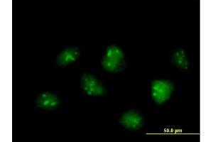 Immunofluorescence of  purified  MaxPab antibody to IFRD2 on HeLa cell.