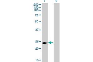 Western Blot analysis of C16orf5 expression in transfected 293T cell line by C16orf5 MaxPab polyclonal antibody. (CDIP1 antibody  (AA 1-208))