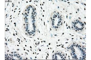 Immunohistochemical staining of paraffin-embedded breast tissue using anti-NRBP1 mouse monoclonal antibody. (NRBP1 antibody)