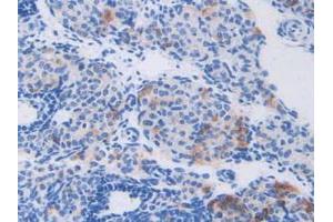 IHC-P analysis of Mouse Ovary Tissue, with DAB staining. (CAPNL1 antibody  (AA 387-694))