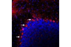 Immunohistochemistry (IHC) image for anti-Adenylate Cyclase Activating Polypeptide 1 (Pituitary) Receptor Type I (ADCYAP1R1) (AA 474-487), (Intracellular) antibody (ABIN7042894)