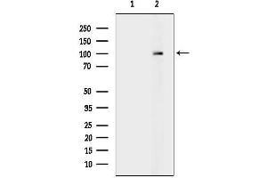 Western blot analysis of lysates from HepG2 cells(heat-shock treatment), using CMTR1 Antibody.