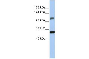 WB Suggested Anti-ZSCAN20 Antibody Titration:  0. (ZSCAN20 antibody  (Middle Region))