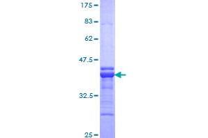 Image no. 1 for Teashirt Zinc Finger Homeobox 1 (TSHZ1) (AA 619-717) protein (GST tag) (ABIN1323892) (TSHZ1 Protein (AA 619-717) (GST tag))
