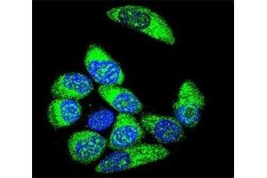 Confocal immunofluorescent analysis of WT1 antibody with MCF-7 cells followed by Alexa Fluor 488-conjugated goat anti-rabbit lgG (green). (WT1 antibody  (AA 346-375))