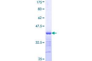 MYBPC1 Protein (AA 506-603) (GST tag)