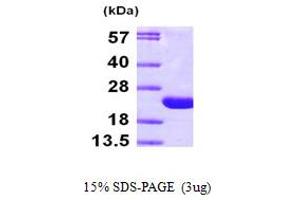 SDS-PAGE (SDS) image for ADP-Ribosylation Factor 6 (ARF6) (AA 1-175) protein (His tag) (ABIN667279)