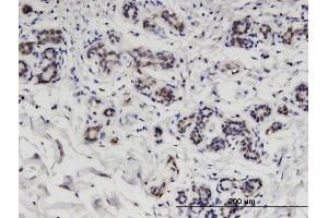 Immunoperoxidase of monoclonal antibody to CCDC115 on formalin-fixed paraffin-embedded human breast. (CCDC115 antibody  (AA 1-132))