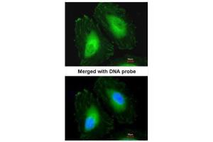 ICC/IF Image Immunofluorescence analysis of paraformaldehyde-fixed HeLa, using Beta-crystallin A4, antibody at 1:200 dilution. (CRYbA4 antibody)