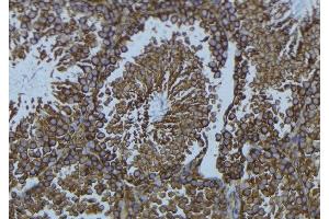 Immunohistochemistry (IHC) image for anti-Tryptophan Hydroxylase 1 (TPH1) (Internal Region) antibody (ABIN6265687)