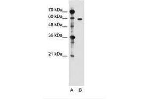 Image no. 2 for anti-Zinc Finger, DHHC-Type Containing 13 (ZDHHC13) (N-Term) antibody (ABIN205045) (ZDHHC13 antibody  (N-Term))