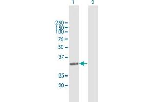 Western Blot analysis of NAT1 expression in transfected 293T cell line by NAT1 MaxPab polyclonal antibody. (NAT1 antibody  (AA 1-290))